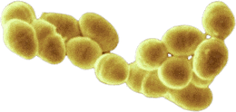 Ruminococcus sp.